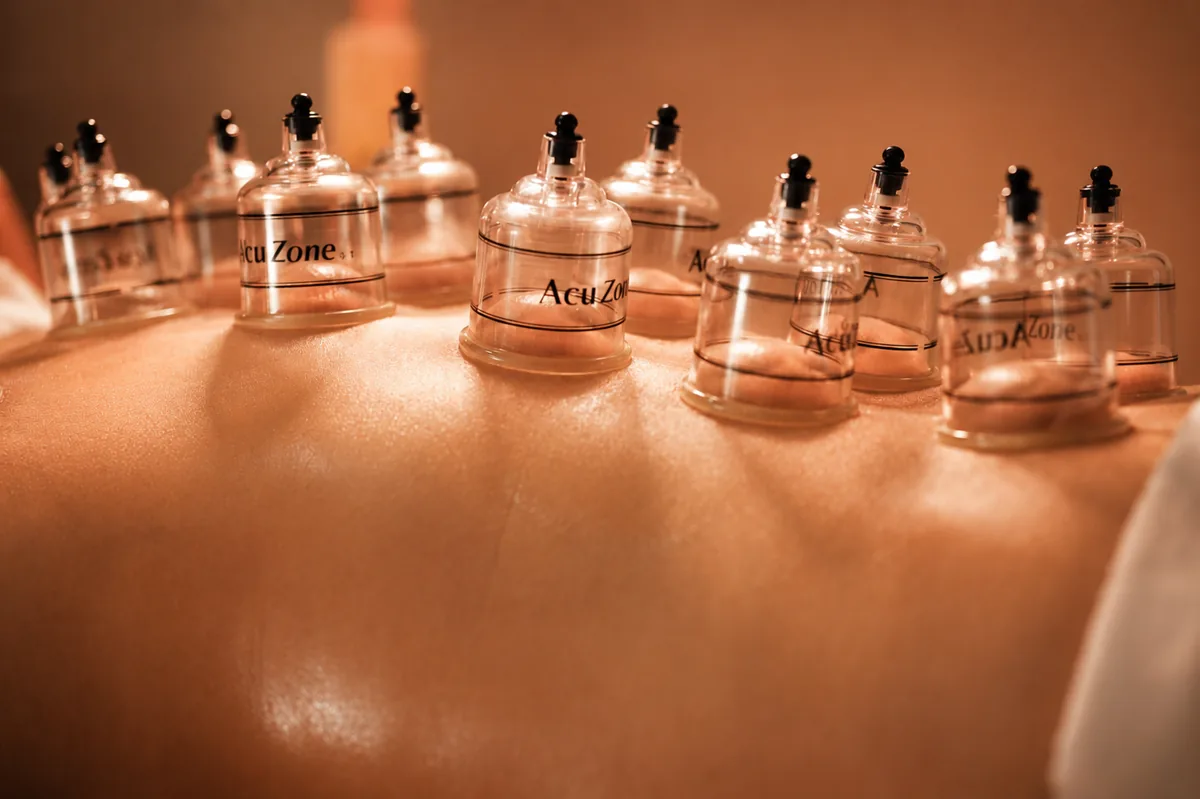 Cupping therapy cups placed along a client's back in warm light